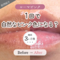 たった1度の施術で血色感のある自然なピンクリップになる？ローマピンクリップ３ヶ月後の経過