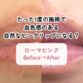 たった1度の施術で血色感のある自然なピンクリップになる？ローマピンクリップ３ヶ月後の経過