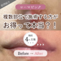 ローマピンクの施術は複数部位がお得？！リップと乳輪のビフォーアフター公開