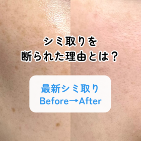 shimi-tori-face-before-after-1month.jpg