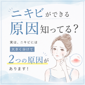 ニキビができる原因 白ニキビ 赤ニキビ ニキビ予防 スキンケア
