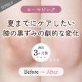 膝の黒ずみを自然な肌色へ｜ローマピンク3ヶ月後のビフォーアフター